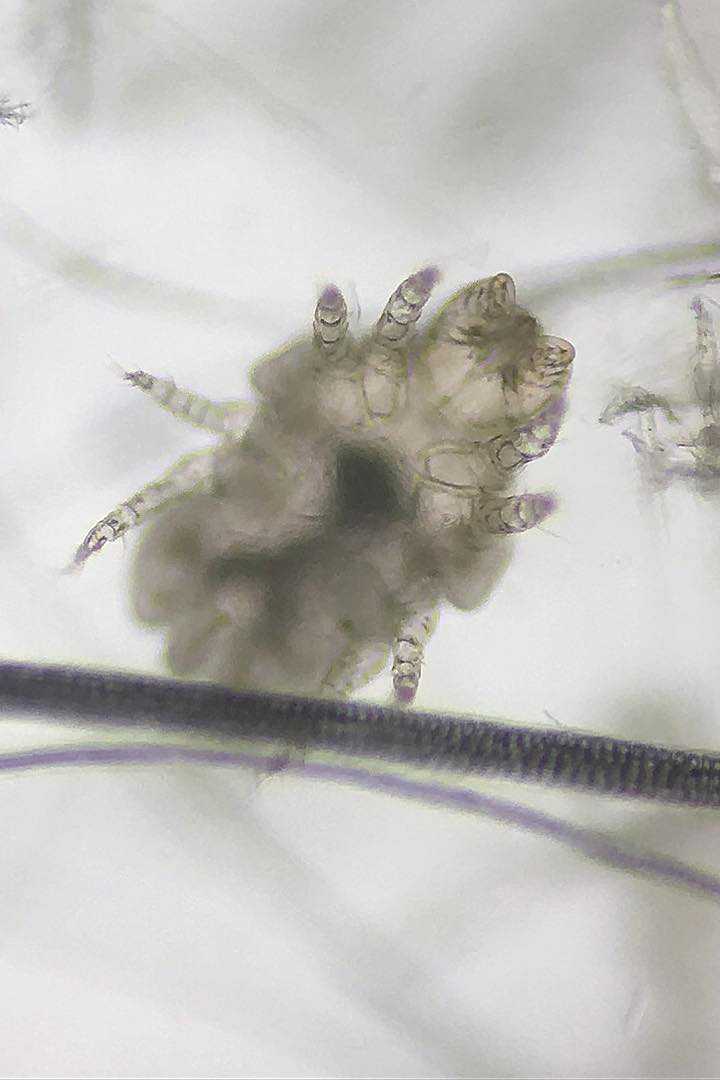 early stage rabbit mites on humans